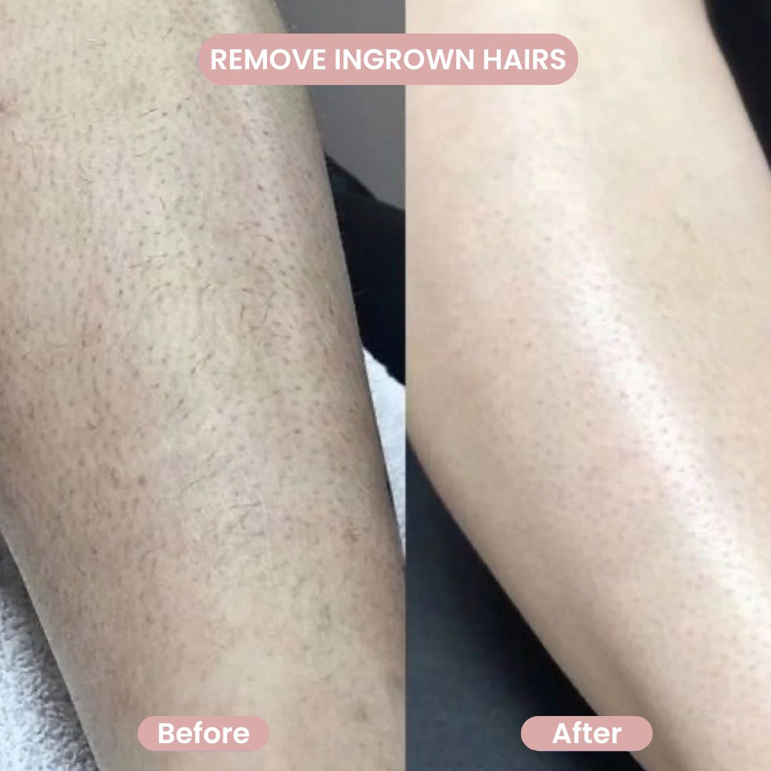 2-in-1 Women’s Body Shaver - Precision Grooming Ritual | Louvrs